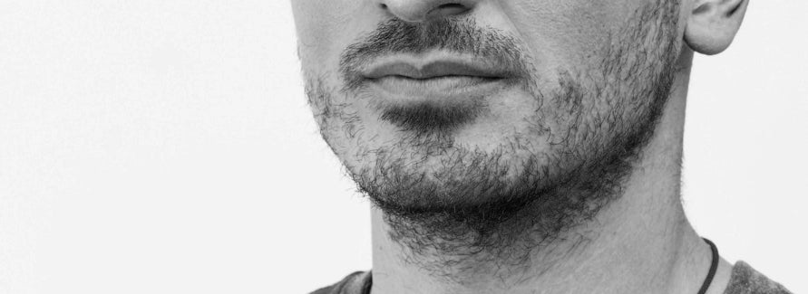 How to Fix a Patchy Beard: Essential Tips and Tricks